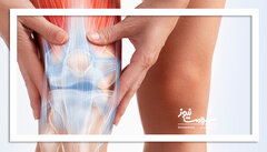 چگونه آرتریت زانو را مهار کنیم