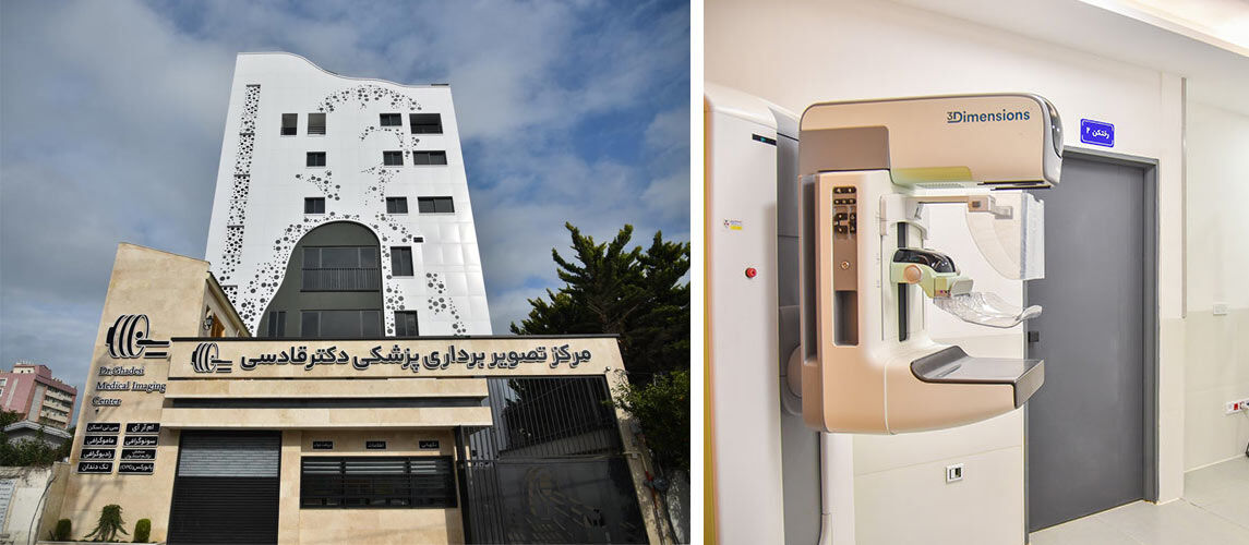 تنها دستگاه ماموگرافی سه بعدی برند هالوژیک آمریکا مجهز به وکیوم بیوپسی و Contrast Enhanced در مازندران تنها دستگاه ماموگرافی سه بعدی برند هالوژیک آمریکا مجهز به وکیوم بیوپسی و Contrast Enhanced در مازندران
