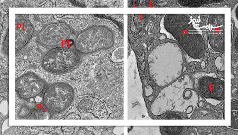 هوش مصنوعی راز تعادل سیستم ایمنی روده را فاش کرد: همکاری GIV و NOD2