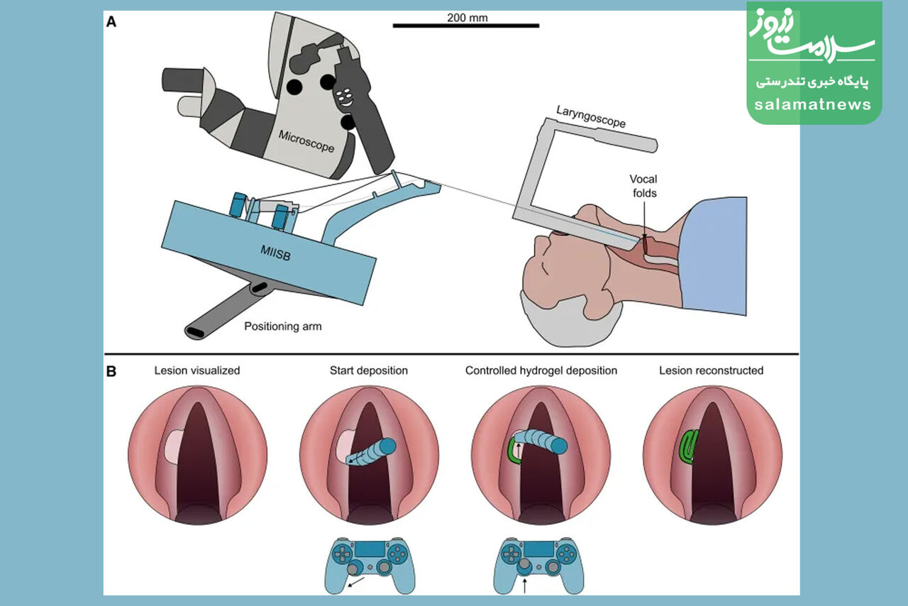 ساخت ربات زیستی ۲.۷ میلیمتری برای ترمیم تارهای صوتی آسیبدیده
