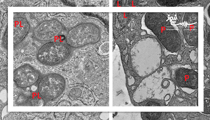 هوش مصنوعی راز تعادل سیستم ایمنی روده را فاش کرد: همکاری GIV و NOD2 هوش مصنوعی راز تعادل سیستم ایمنی روده را فاش کرد: همکاری GIV و NOD2