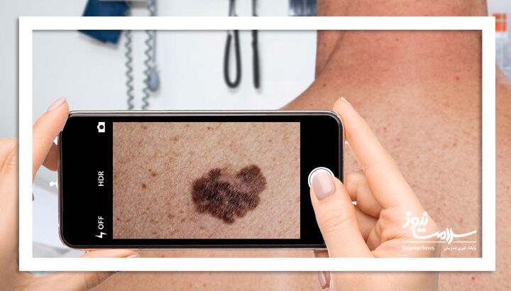 ویزیت پوست با یک عکس/آینده تلهدرماتولوژی در کشور ویزیت پوست با یک عکس/آینده تلهدرماتولوژی در کشور