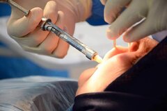 لبخندت را دوباره بساز! زیبایی و ایمپلنت دندان با دکتر متخصص در سنندج