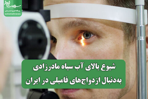 شیوع بالای آب سیاه مادرزادی به‌دنبال ازدواج‌های فامیلی در ایران