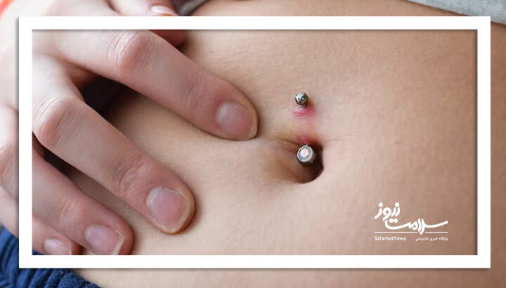 عفونت ناف می‌تواند خطرناک یا حتی مرگبار باشد