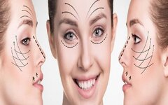 عمل های زیبایی پرطرفدار برای داشتن چهره‌ ای نچرال