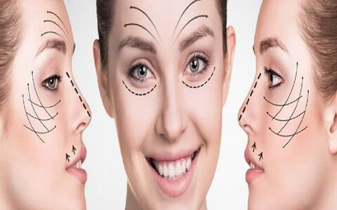 عمل های زیبایی پرطرفدار برای داشتن چهره‌ ای نچرال