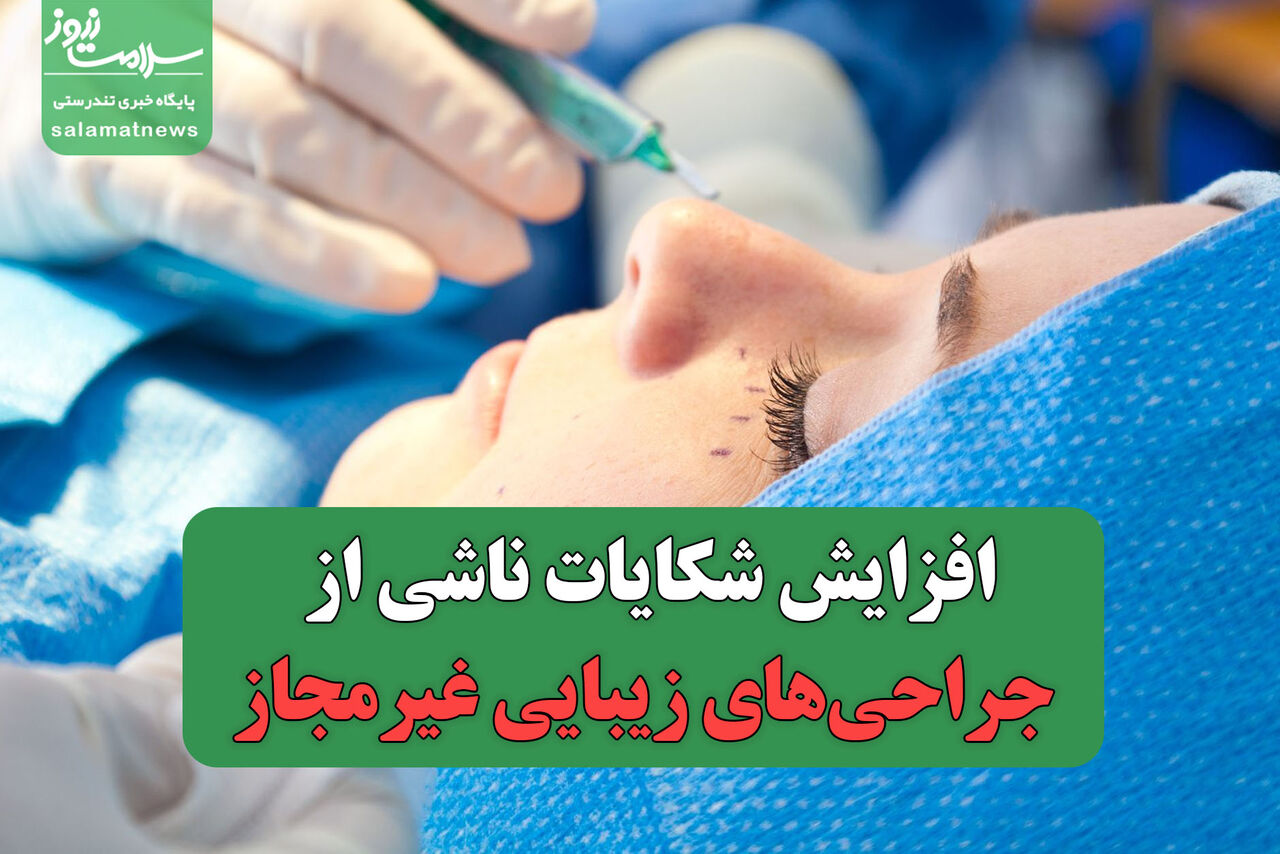 افزایش شکایات ناشی از جراحی‌های زیبایی غیرمجاز؛ قوه قضائیه وارد میدان شد