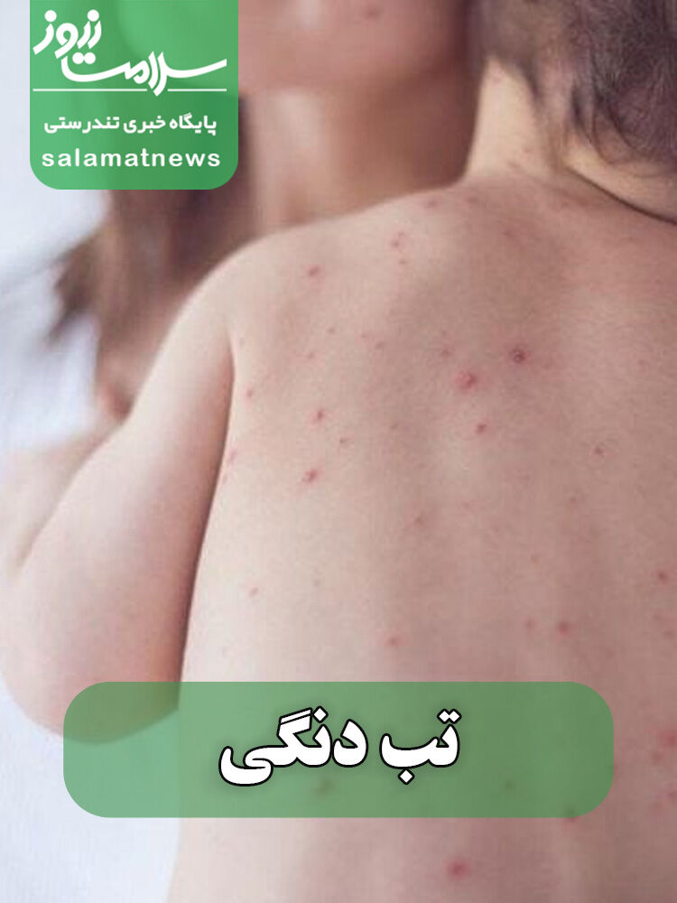 شایع‌ترین بثورات ویروسی در نوزادان