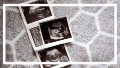 مراقبت های سه ماهه دوم بارداری؛ توصیه‌های کلیدی متخصصان برای سلامت مادر و جنین