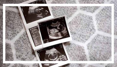 مراقبت های سه ماهه دوم بارداری؛ توصیه‌های کلیدی متخصصان برای سلامت مادر و جنین