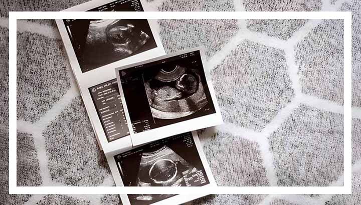 مراقبت های سه ماهه دوم بارداری؛ توصیه‌های کلیدی متخصصان برای سلامت مادر و جنین