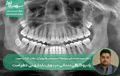 رادیوگرافی دندانی در دوران بارداری بی‌خطر است؛ رعایت اصول ایمنی ضروری است