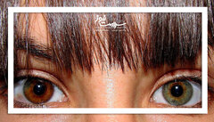 جراحی زیبایی خطرناکی که پشیمانی به بار می‌آورد