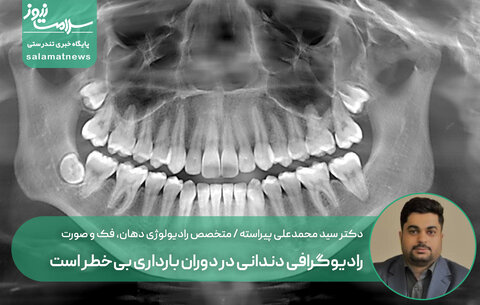 رادیوگرافی دندانی در دوران بارداری بی‌خطر است؛ رعایت اصول ایمنی ضروری است