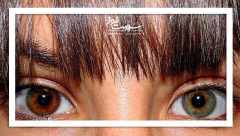 جراحی زیبایی خطرناکی که پشیمانی به بار می‌آورد