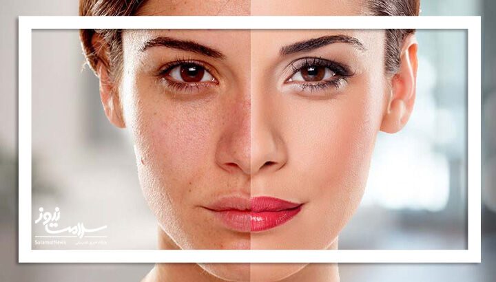 بهترین خوراکی‌ها برای داشتن پوست درخشان