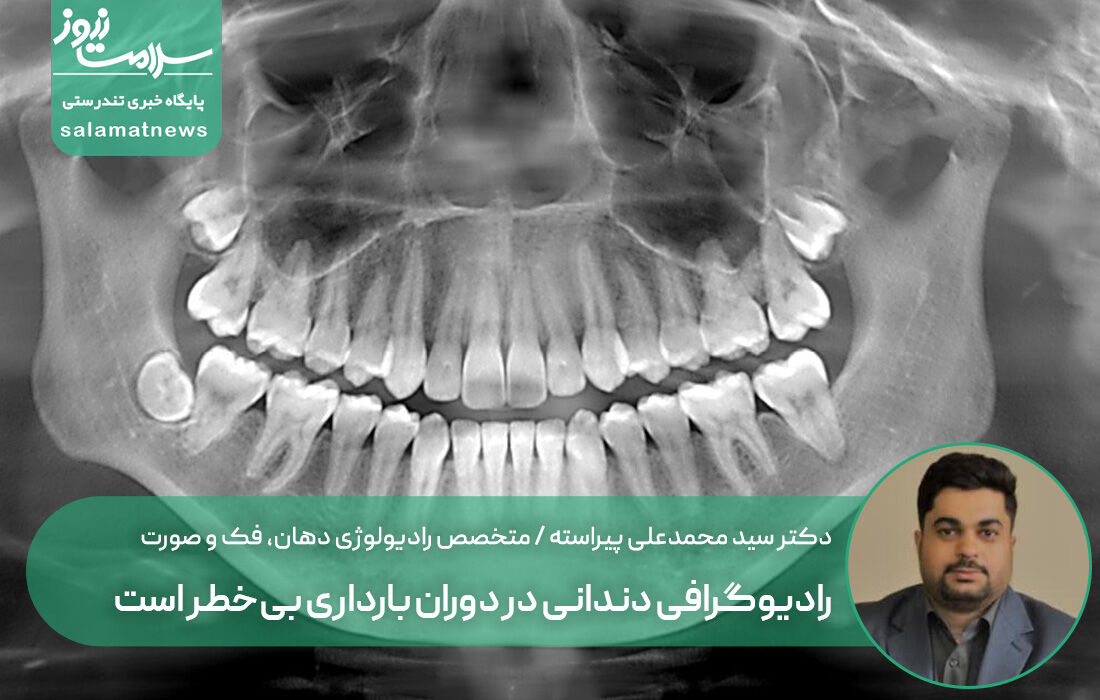 رادیوگرافی دندانی در دوران بارداری بی‌خطر است؛ رعایت اصول ایمنی ضروری است