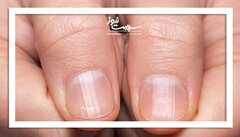 تغییرات هلال ناخن را جدی بگیرید