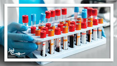 چه زمانی آزمایش خون ضروری است؟