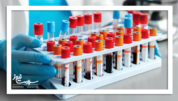 چه زمانی آزمایش خون ضروری است؟