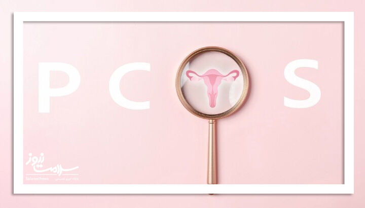 ۶ راهکار ساده و مؤثر برای مدیریت علائم PCOS ۶ راهکار ساده و مؤثر برای مدیریت علائم PCOS