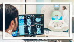 هوش‌مصنوعی می‌تواند استرس را تشخیص دهد