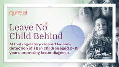 انقلابی در تشخیص سل کودکان با هوش مصنوعی