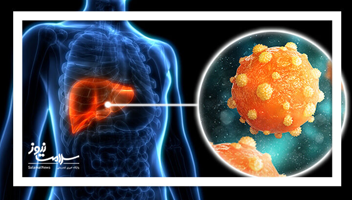 هر آنچه لازم است در مورد هپاتیت بدانید