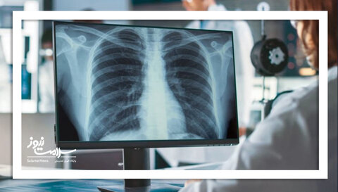 هوش مصنوعی از روی عکس رادیولوژی پوکی استخوان را تشخیص میدهد