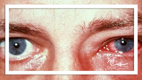 عوارض آلودگی هوا بر چشم