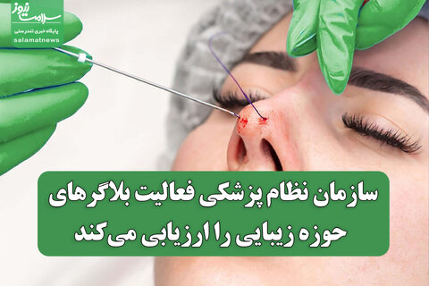 سازمان نظام پزشکی فعالیت بلاگرهای حوزه زیبایی را ارزیابی می‌کند