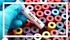 قند ناشتا طبیعی اما HbA1c بالا؟