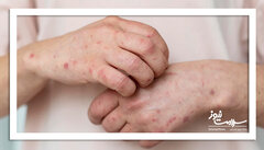 نشانه های کمتر شناخته شده یک روده ناسالم