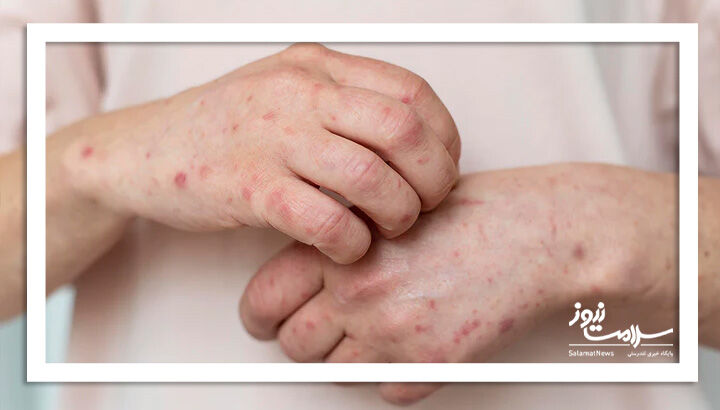 نشانه های کمتر شناخته شده یک روده ناسالم