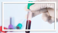 بالا بودن تعداد پلاکت خون می‌تواند منجر به مشکلات جدی سلامتی شود؟