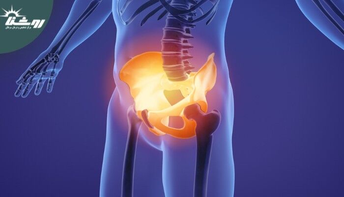 چرا برخی دردهای لگنی هرگز نباید نادیده گرفته شوند؟