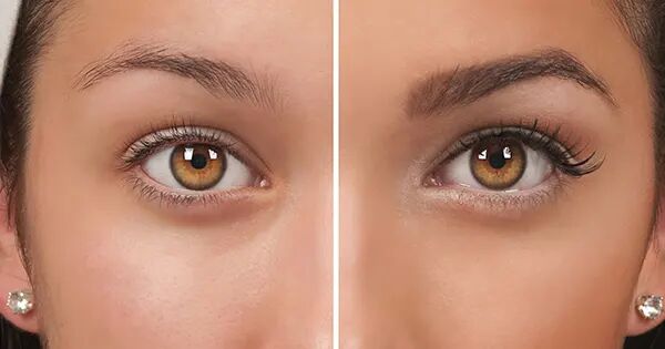 کاشت ابرو در مشهد ؛ انتخابی که می‌تواند چهره و اعتماد به‌ نفس را متحول کند