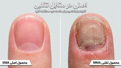 عوارض خاموش و هولناک مواد تقلبی کاشت ناخن؛ هشدار جدی به بانوان و ناخن‌کاران