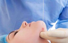 اندولیفت برای لاغری و جوانسازی دروغه یا واقعیت داره؟