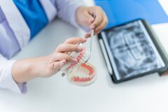 پیش از شروع کاشت ایمپلنت اقساطی در غرب تهران چه نکاتی را باید بدانیم