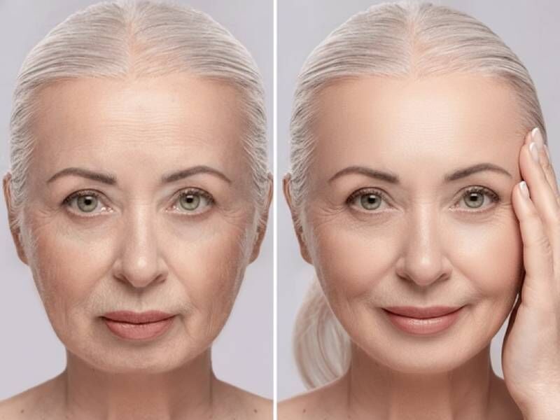 چه سرمی برای لیفت صورت خوبه؟