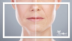 چرا در زمستان رطوبت پوست کم میشود؟