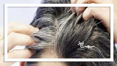 بازگشت رنگ موها پس از سفیدی