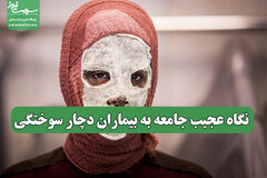 نگاه عجیب جامعه به بیماران دچار سوختگی