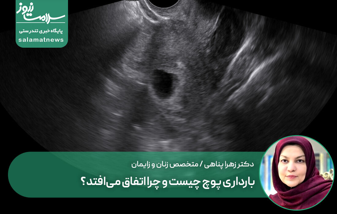 بارداری پوچ چیست و چرا اتفاق می‌افتد؟
