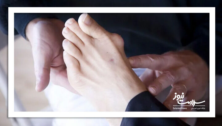 آیا می‌توان انحراف شست پا (بونیون) را بدون جراحی کمتر کرد؟