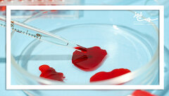 آزمایش خون قاعدگی؛ راهی ساده‌تر برای غربالگری سرطان دهانه رحم