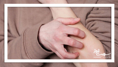 چگونه خارش ناشی از اضطراب را مدیریت کنیم؟