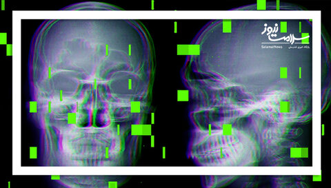 هشدار FDA: دستگاه‌های AI در اتاق عمل ممکن است جان بیماران را به خطر بیندازند